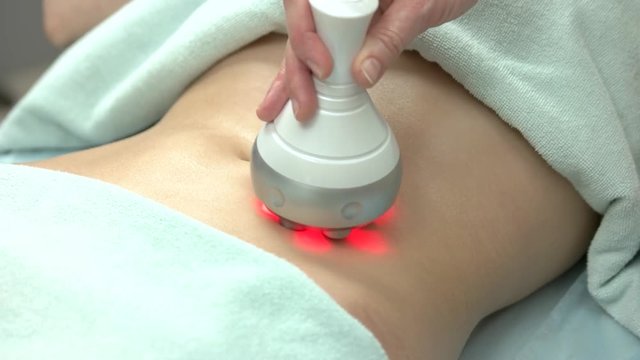 Rf skin tightening, female belly. Body of woman, cosmetology procedure. Body contouring and cellulite reduction.