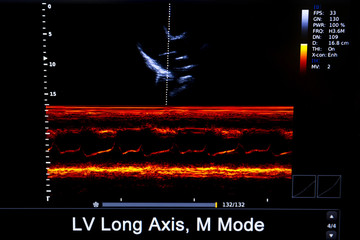 Colourful image of modern ultrasound monitor