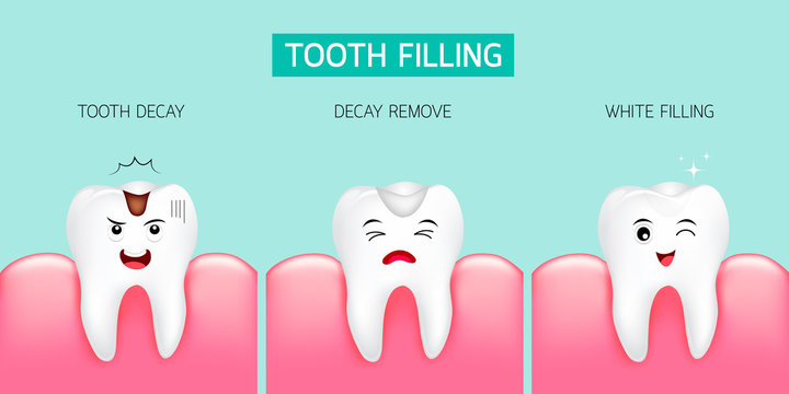 Step of tooth filling. Tooth decay, decay remove and white filling. Cute cartoon design, illustration isolated on green background. Dental care concept.