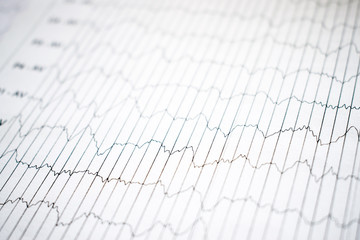EEG electrophysiological monitoring method. EEG wave in human brain, Brain wave patterns on...