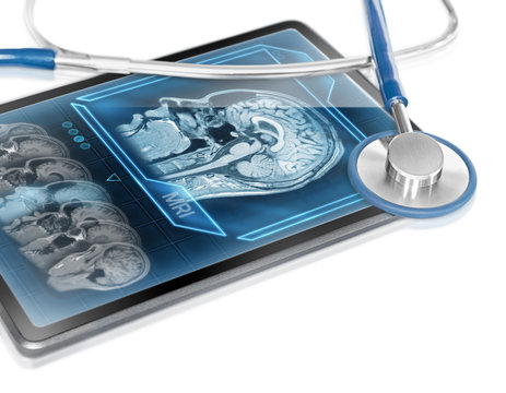 Modern tablet displaying cerebral scan