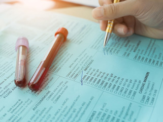 Selective focus Check list of hematological blood tests