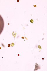Phacus is a genus of unicellular protists, of the phylum Euglenozoa.