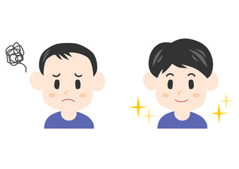 薄毛に悩む男性のイラスト