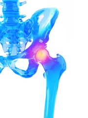 3d rendered medically accurate illustration of a painful hip joint