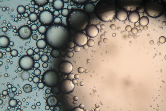 Mixture of soap and oil viewed under the microscope.