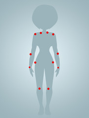 illustration of Fibromyalgia