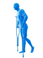 3d rendered medically accurate illustration of a man with crutches