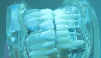 Dental teeth mouth model