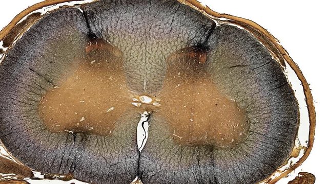 microscopic cross section of spinal cord