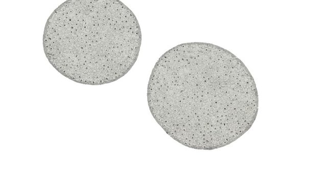 mitosis of eggs of a roundworm - cross section under microscope