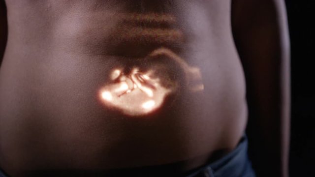  Growing foetus in the womb of expectant mother