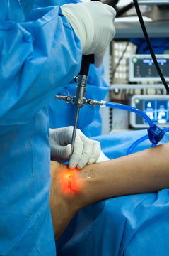 doctor surgical intervention ankle surgery