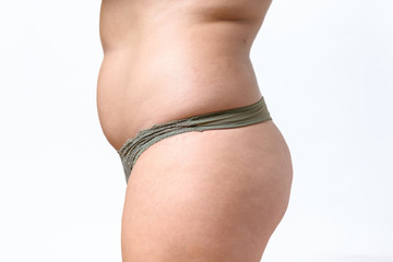 Side view of overweight woman wearing panties