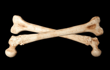 Skeleton bones - obrazy, fototapety, plakaty