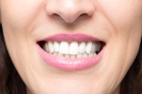 Close up of white teeth of woman