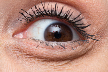 Macro of wrinkles in a puffy eye