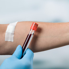 Hand mit Blutprobe neben einem Arm mit Pflaster  dem Blut abgenommen wurde