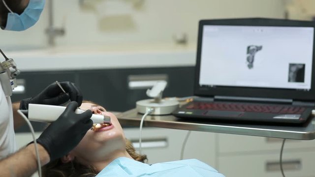 Dentist scanning the teeth of patient with a d scanner