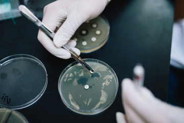 Medical technicians  working with microbiology media plates. She is working on bacterial culture, researching and analyzing.