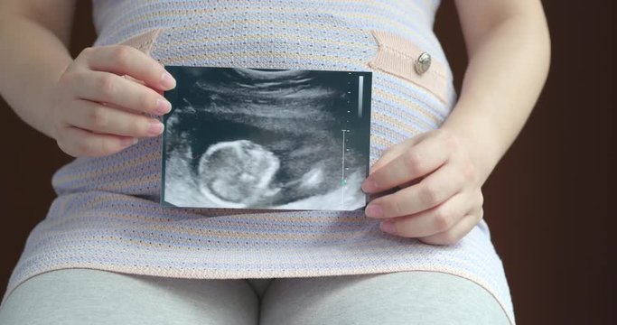 Pregnant women holding Ultrasound scan photo on her belly