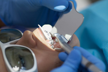 Dental laser used on a patient on soft and hard tissue. Dental health, modern technology and oral hygiene concept.