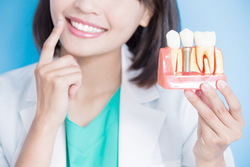 woman dentist take implant tooth