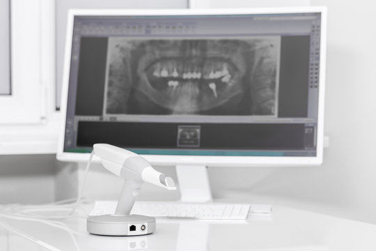 Dental 3d scanner and monitor in the dentist's office