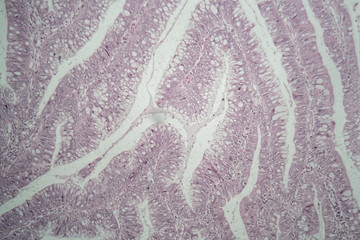 Cells of a human large intestine under the microscope