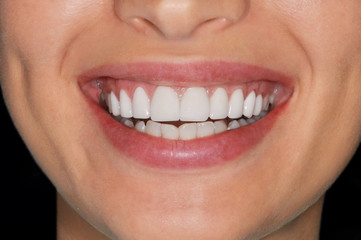 Close up of beautiful healthy white teeth smiling woman