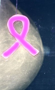 Pink ribbon on a background of a mammography image. X-ray. World Breast Cancer Day