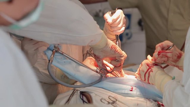 The surgeons hands with medical tools make a operation. close-up