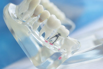 Dental teeth mouth model