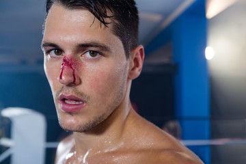 Close-up portrait of young boxer with bleeding nose