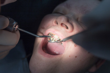 The dentist works with the client in the clinic