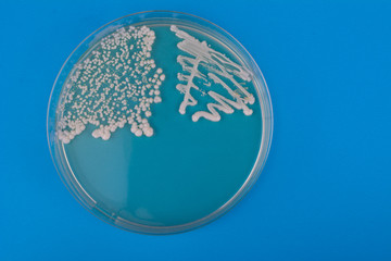 Petri dish with bacteria on blue background. Candida albicans bacteria on agar plate