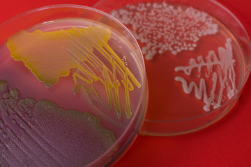 Petri dishes with bacterial colonies on red background. Closeup