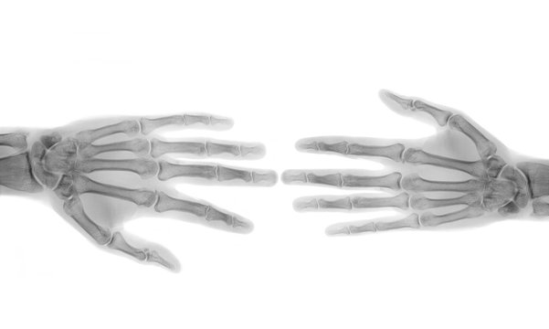 hand tomography x-ray film 