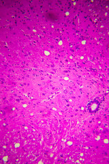 Images of biological tissues in a microscope. Real photo, blur zones possible