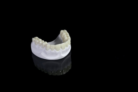 Beauty teeth in model on black screen