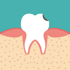 Sectional view tooth