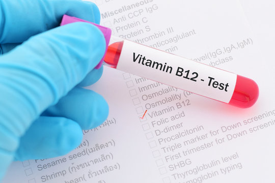 Blood sample with requisition form for vitamin B12 test
