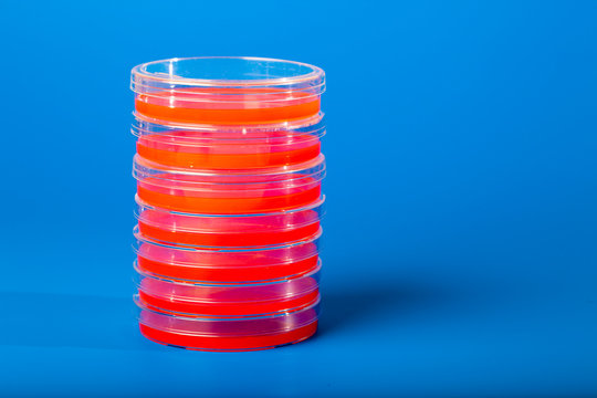 Petri dishes with blood agar