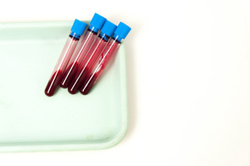 test tubes with blood 