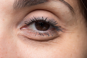 Eye bags on woman face