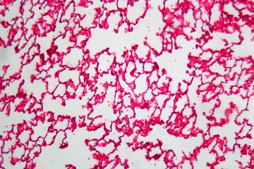 Lung Cells under the Microscope