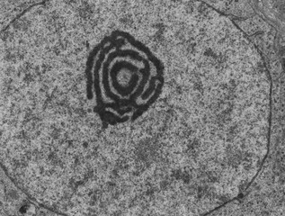 Nucleolus, TEM
