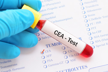 Obraz premium Blood sample for CEA (Carcinoembryonic antigen) test, diagnosis for colorectal cancer