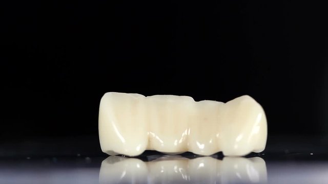 Dental teeth crowns. Bridge with ceramic or zirconia.