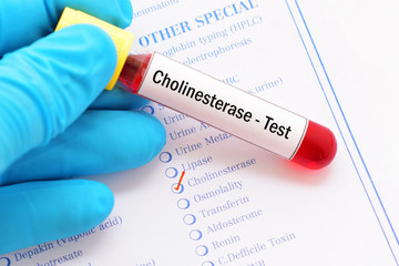 Obraz premium Blood sample for cholinesterase test